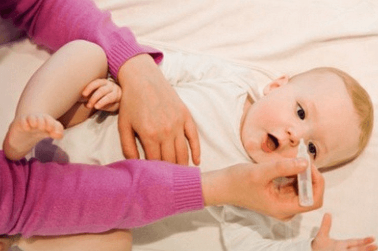 Trẻ sơ sinh bị sổ mũi nên xử lý như thế nào cho hiệu quả?