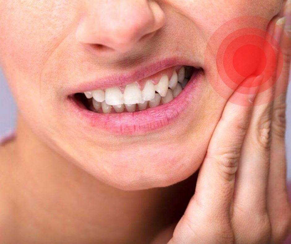 ​​​​​​​Người điều trị Clorpheniramin thời gian dài dễ mắc sâu răng.