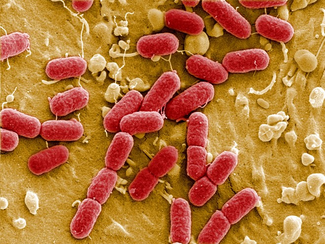 Hình ảnh siêu vi khuẩ kháng thuốc kháng sinh